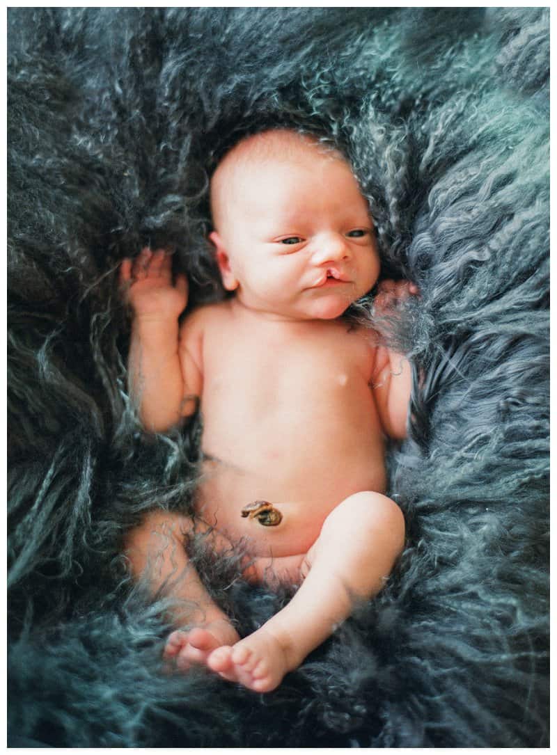 cleft lip baby naked newborn photo